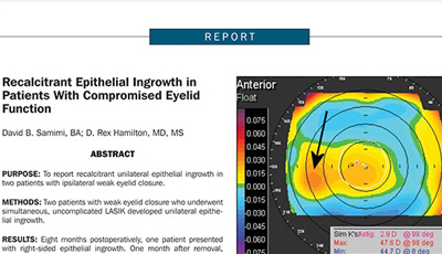 Recalcitrant Epithelial Ingrowth In Patients With Compromised Eyelid Function