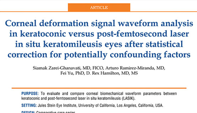 Corneal Deformation Signal Waveform Analysis In